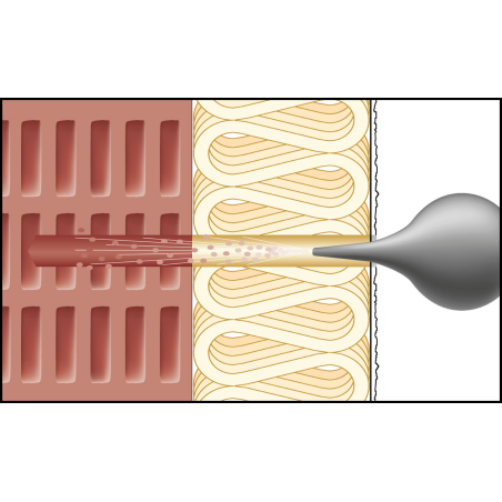 Montagebild ResiTHERM® 12 in Lochstein/Mauerwerk zur energieeffizienten Abstandsmontage an der gedämmten Fassade 3